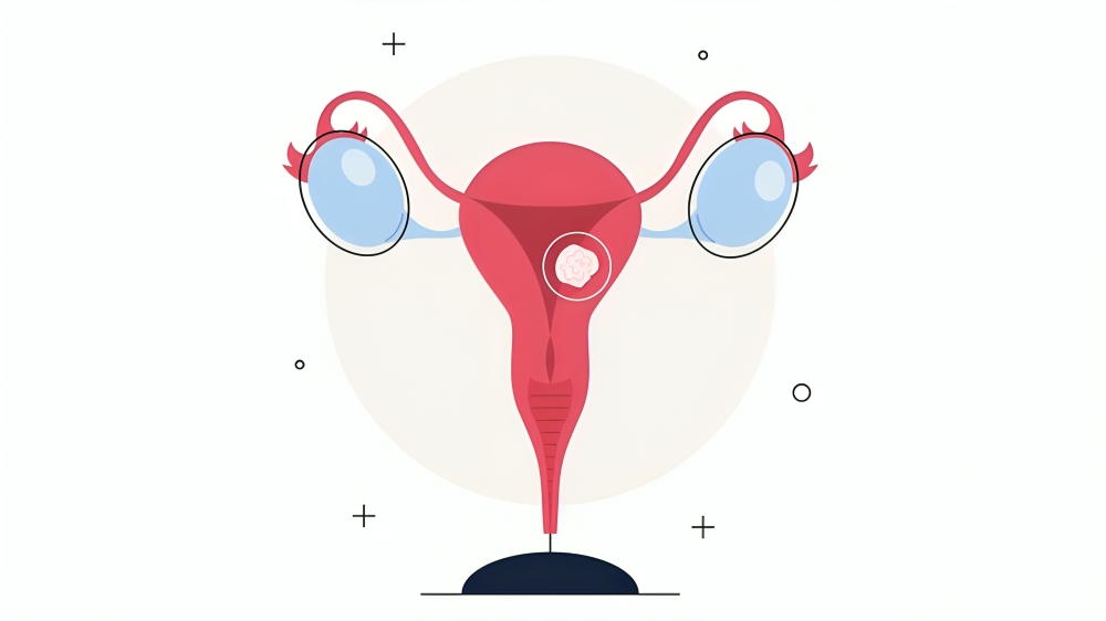 Urinary Incontinence Management in Patients with Primary Endometrial Cancer