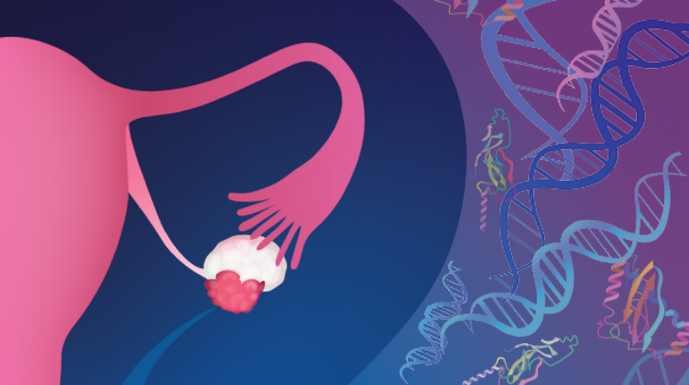 Elizabeth McKenna: Early Detection of Ovarian Cancer Using Cell-Free DNA Fragmentomes and Protein Biomarkers