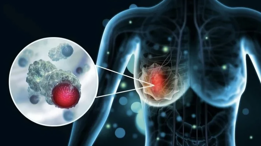 Predictors of Response to CDK4/6i Rechallenge in ER+ Metastatic Breast Cancer