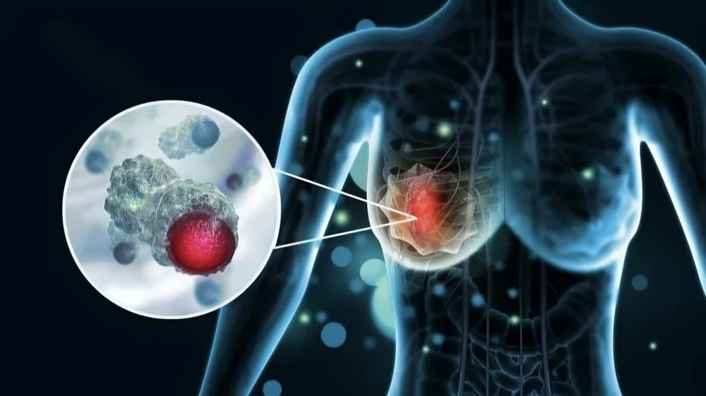 pCR rates for patients with HR+/HER2 breast cancer – Annals of Oncology