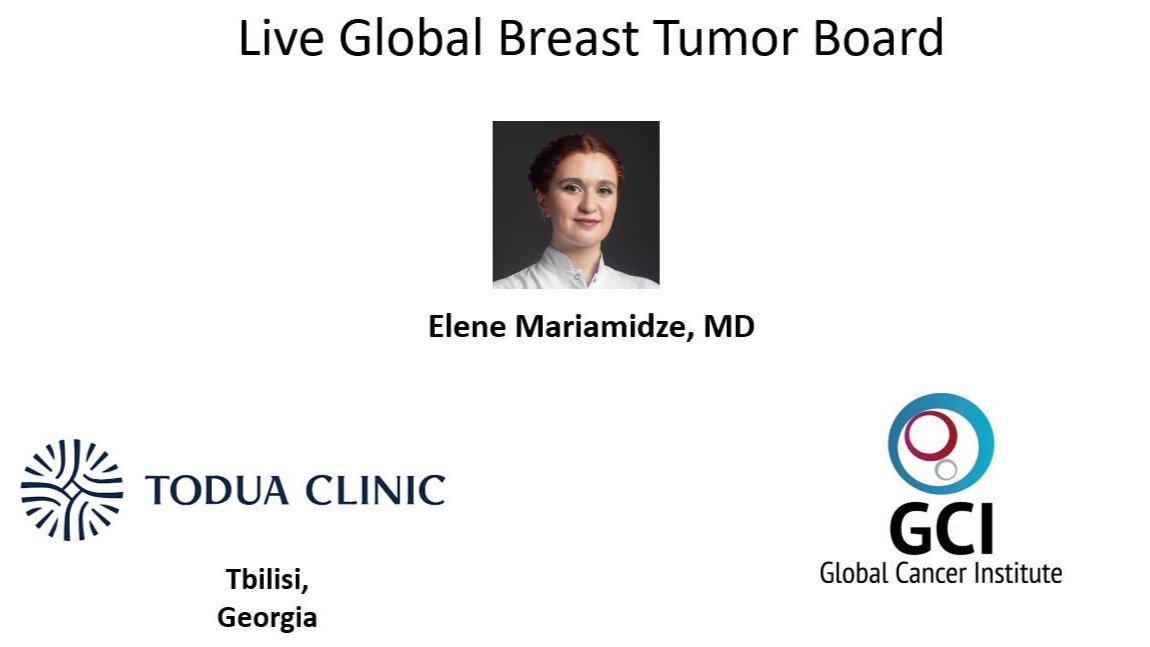 Elene Mariamidze: It’s 2 Georgians presenting on an international oncologists’s board