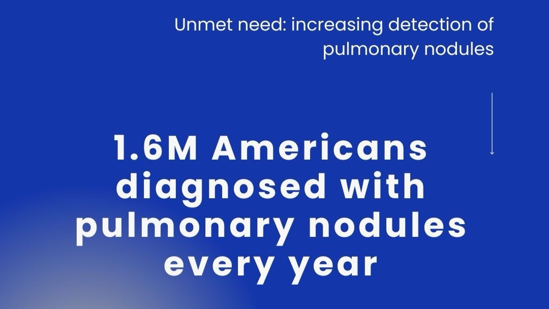 Scott Jacobson: Lung Cancer detection is not only possible it is imperative