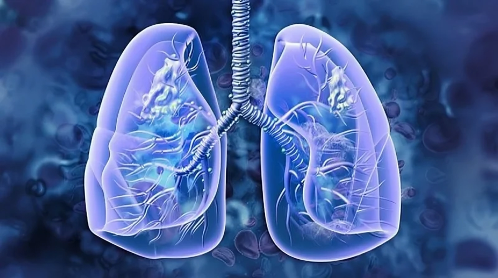 Safety of Lorlatinib in ALK positive NSCLC