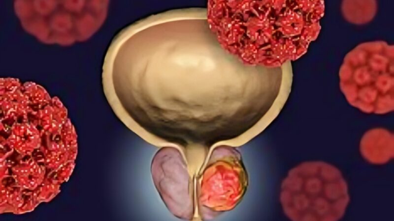 3D spatial localization and volume estimation of prostate tumors
