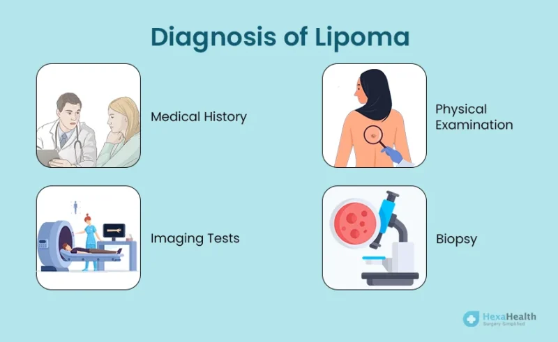 Diagnosis of Lipoma