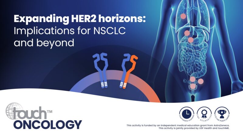 Razelle Kurzrock: Expanding HER2 horizons - Implications for NSCLC and beyond