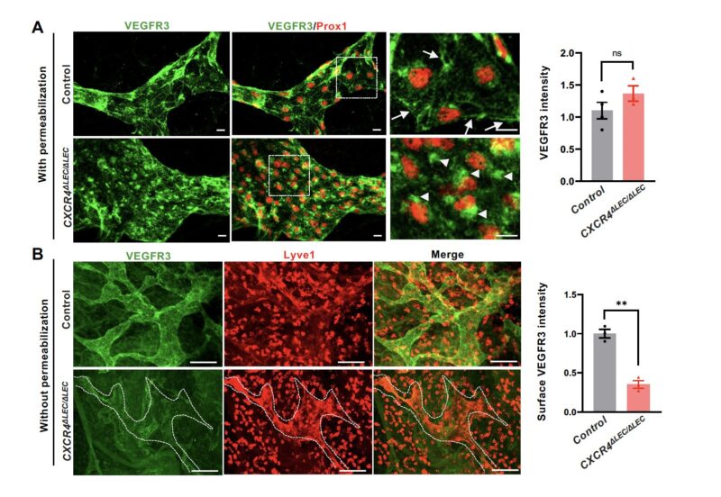 Xiaolei Liu: New insights into lymphatic development by CXCL12/CXCR4 signaling