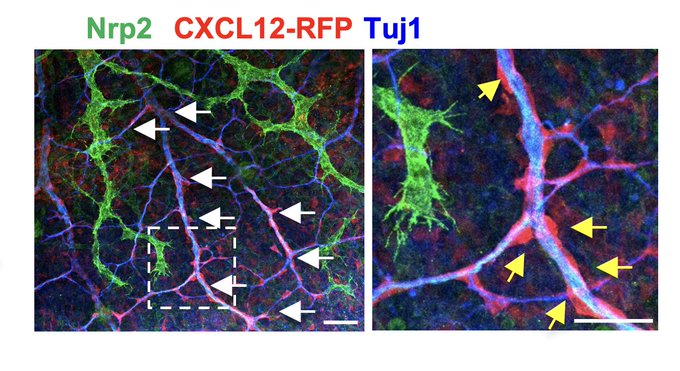 Xiaolei Liu: New insights into lymphatic development by CXCL12/CXCR4 signaling