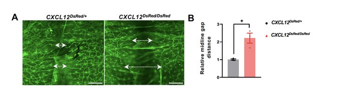 Xiaolei Liu: New insights into lymphatic development by CXCL12/CXCR4 signaling