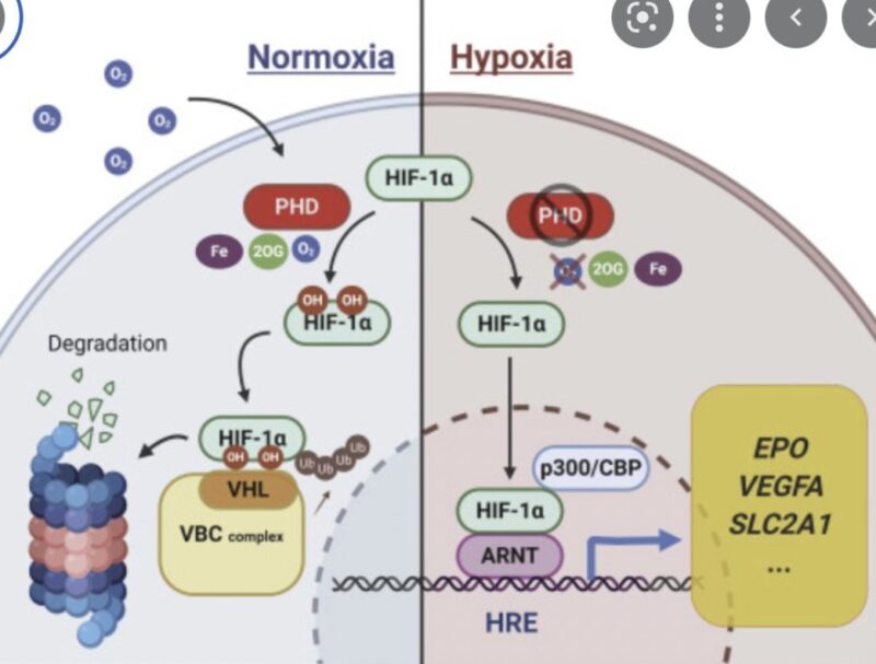 Aaron Goodman: Tumors that Secrete Erythropoietin