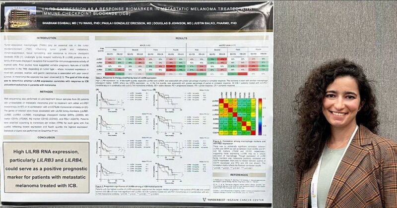 Shabnam Eghbali on Metastatic Melanoma treated with IO therapy - Vanderbilt Hem/Onc