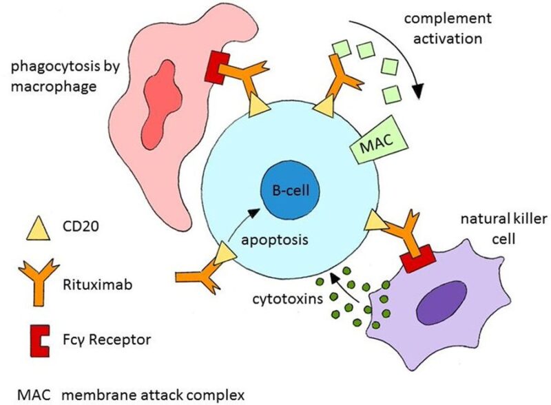 Nico Gagelmann: Current status and Future directions for CAR-T Therapy