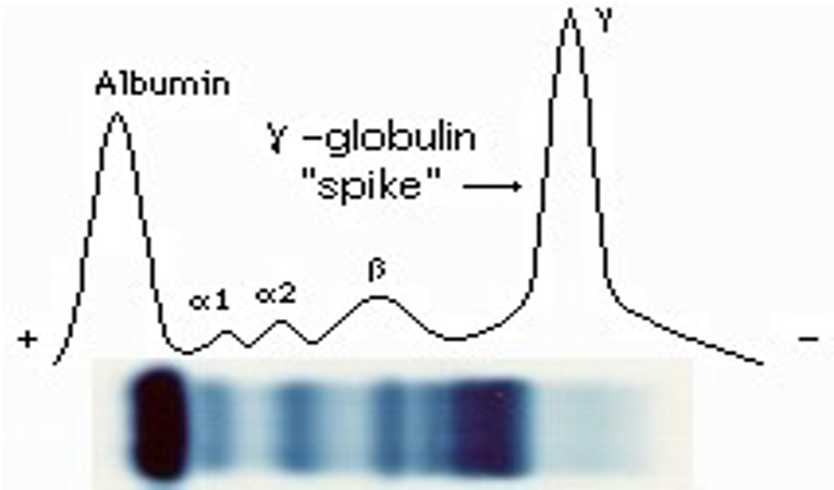 Aaron Goodman: What is an "M protein"