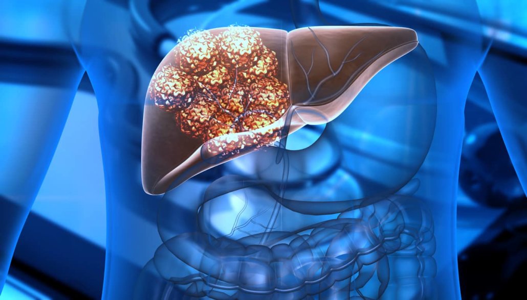 Cathy Eng: Role of ctDNA in resected liver metastasis in colorectal cancer by Koshi Kataoka et. al