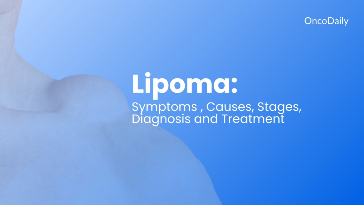 Lipoma: Symptoms, Causes, Stages, Diagnosis and Treatment