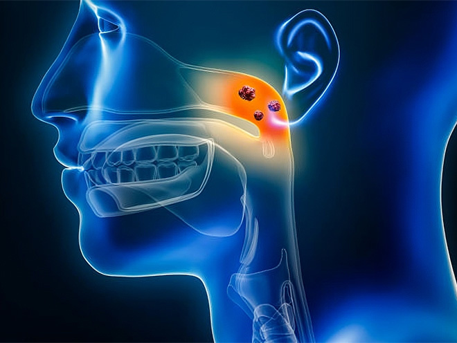 Toripalimab