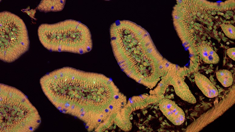 Shaida Ouladan: Characterizing the spatial landscape of gut