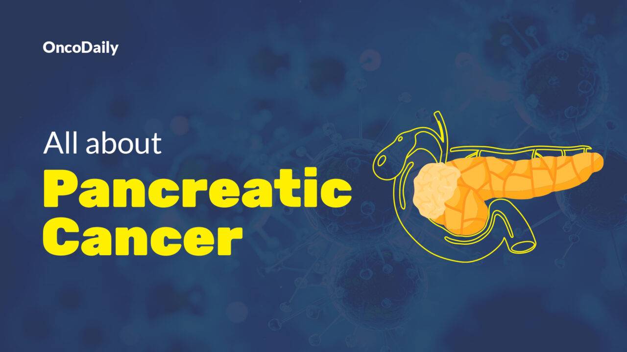 Pancreatic Cancer: Symptoms, Causes, Types, Diagnosis & Treatment