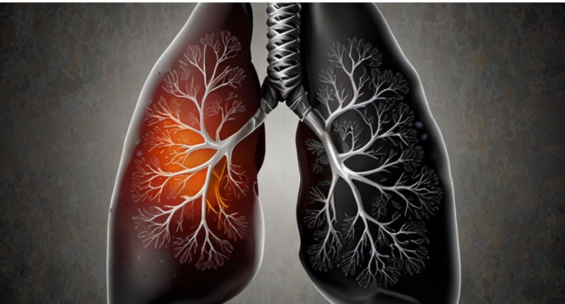 The Importance of Lung Cancer Awareness Month