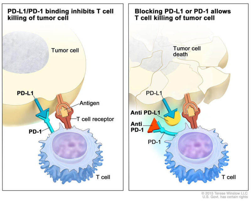 immunotherapy bladder cancer