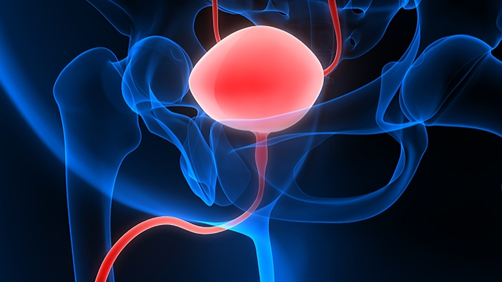 Perioperative Durvalumab with Neoadjuvant Chemotherapy in Bladder Cancer