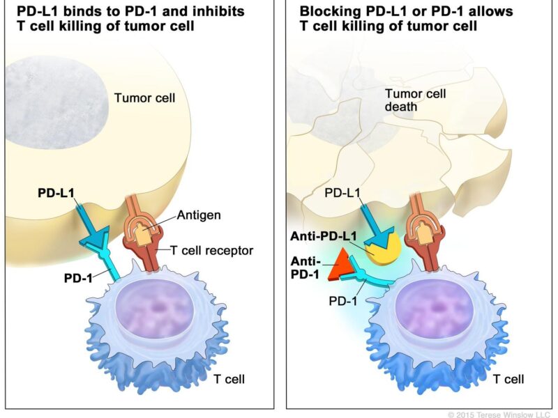 Immunotherapy for Lymphoma: Types, Success Rate, Side Effects and More