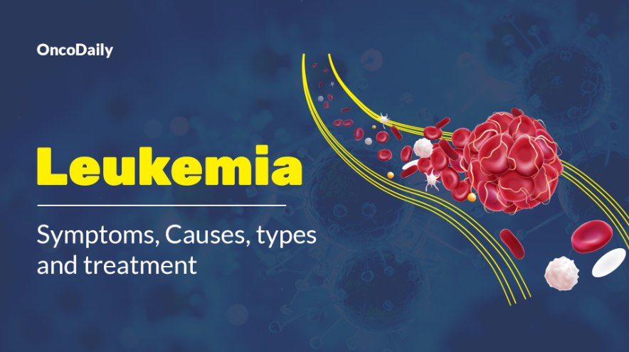 Leukemia: Symptoms, Causes, Types, Diagnosis & Treatment