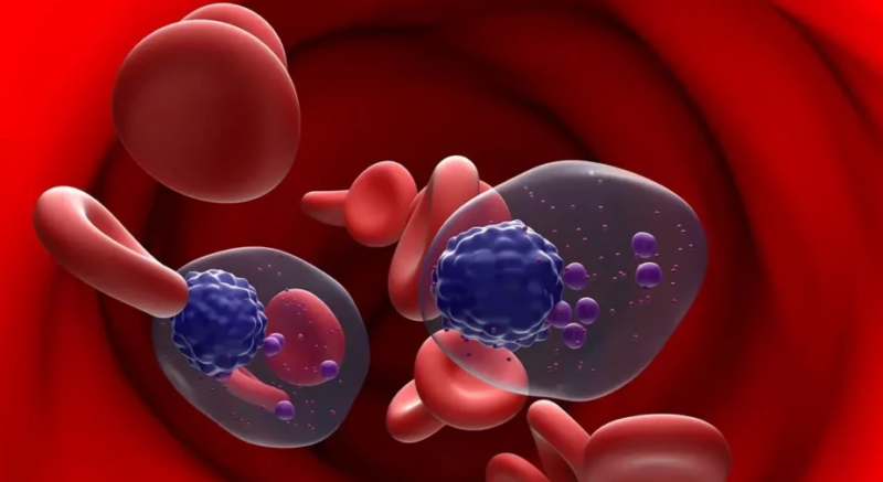 Jean-Baptiste Alberge: Genomic Landscape of Multiple Myeloma and Its Precursor Conditions