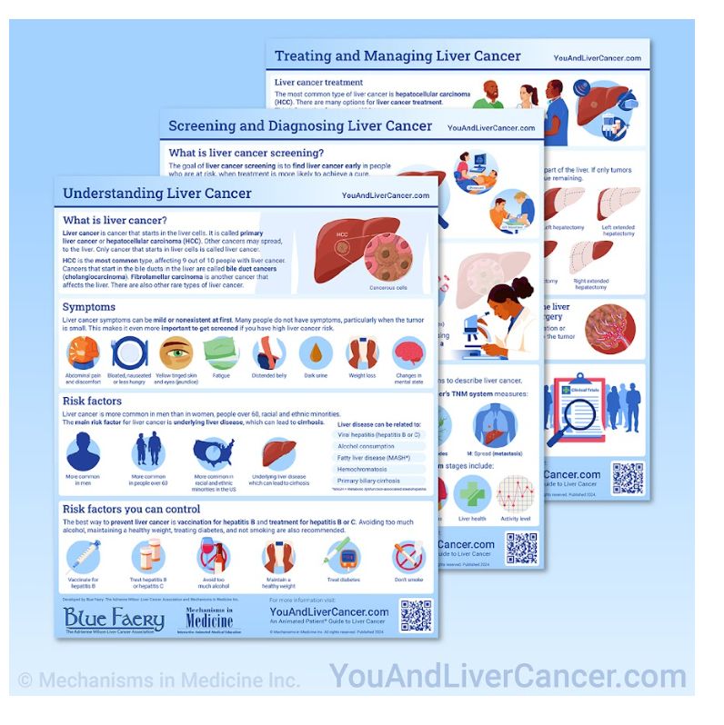 Marina Uchenik: Our Animated Patient Guide to Liver Cancer