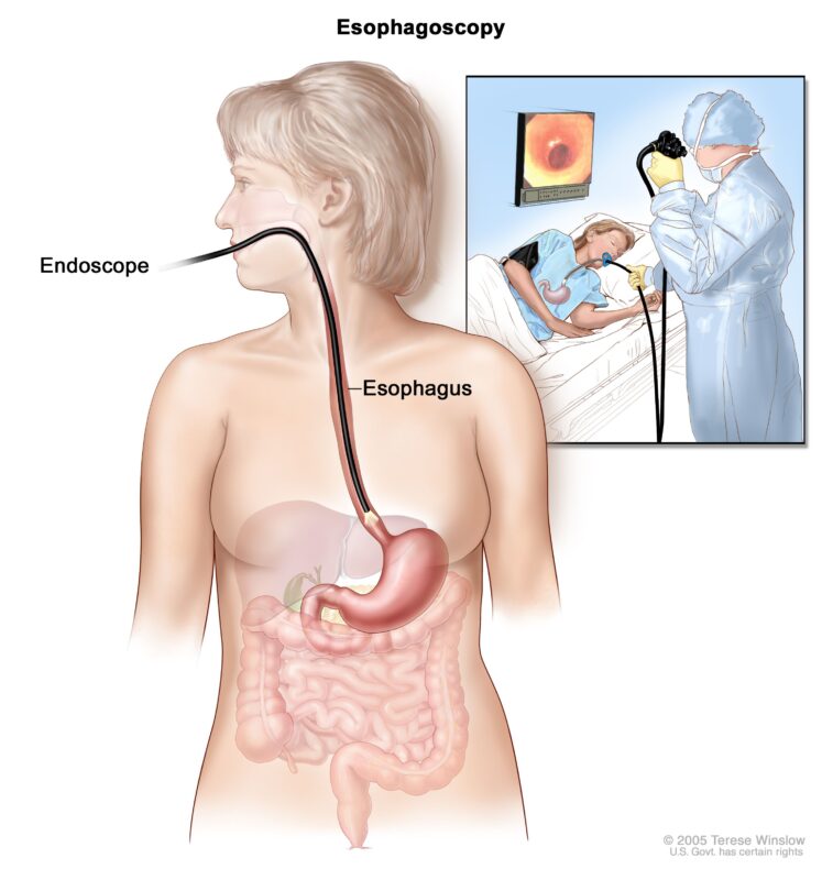 Esophagoscopy