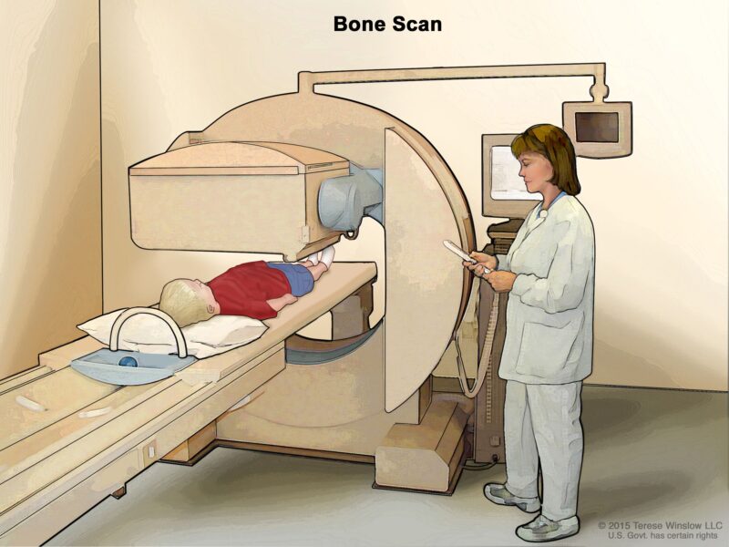 Bone Scan