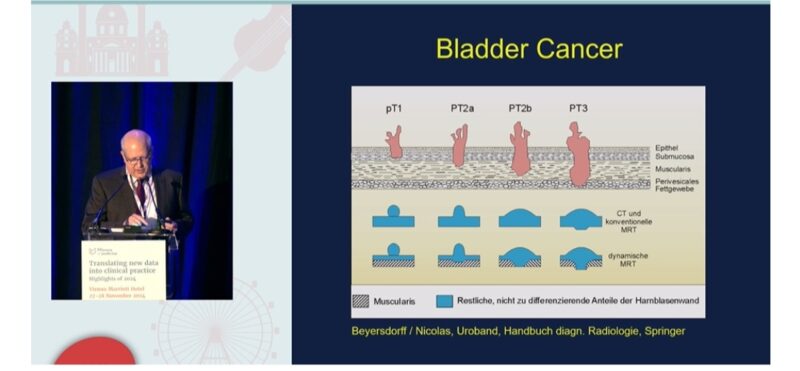 How can mpMRI change management of patients with NMIBC or MIBC?