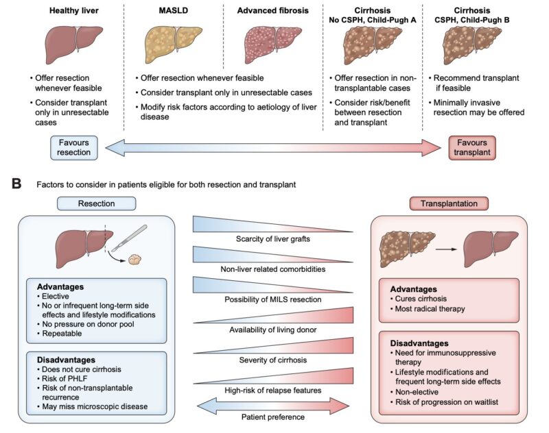 Nina Niu Sanford: Nice to see updated EASL guidelines for HCC now include RT