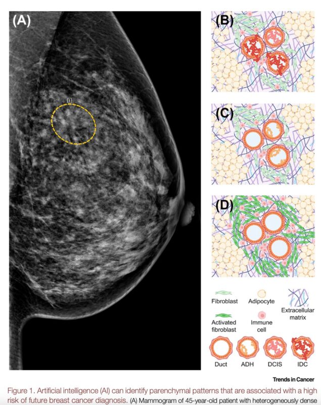 Overview of San Antonio Breast Cancer Symposium (SABCS)