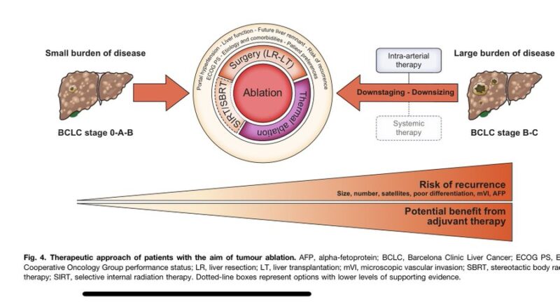 Gustavo Viani: The Role of Radiotherapy on the management of HCC