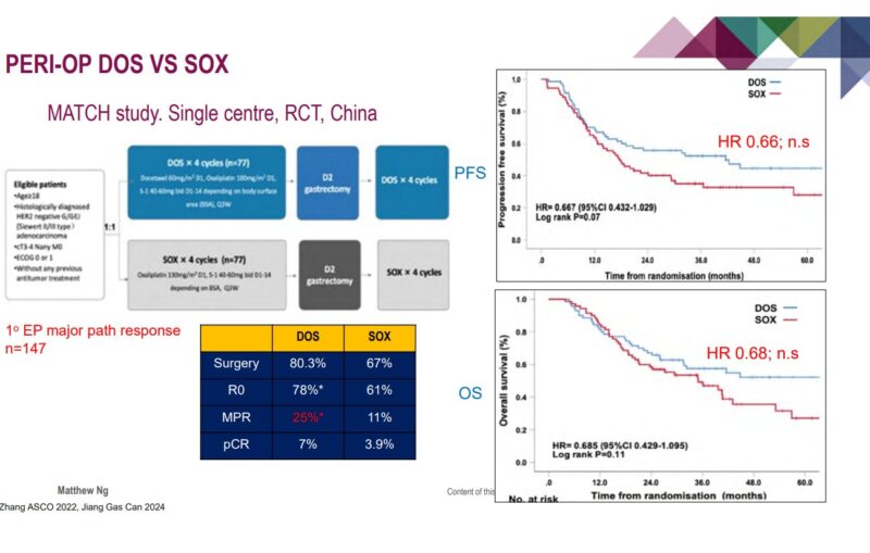 Akhil Santhosh: Perioperative doublet vs triplet study for locally advanced gastric cancer