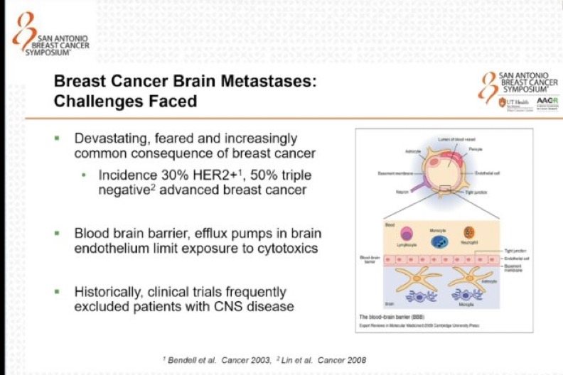 Highlights from Day 4 of SABCS 2024