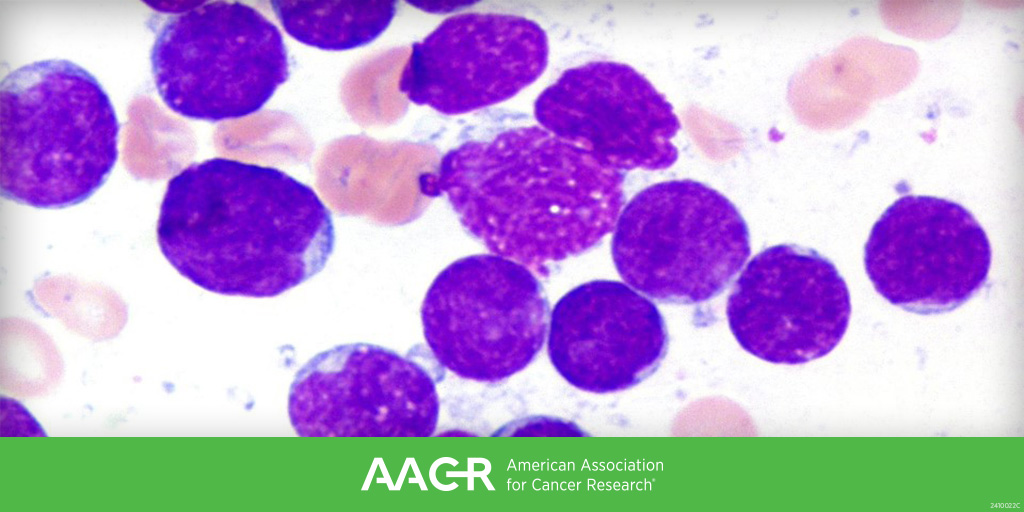 Submit an abstract by December 30 for the AACR Special Conference on Acute Lymphoblastic Leukemia