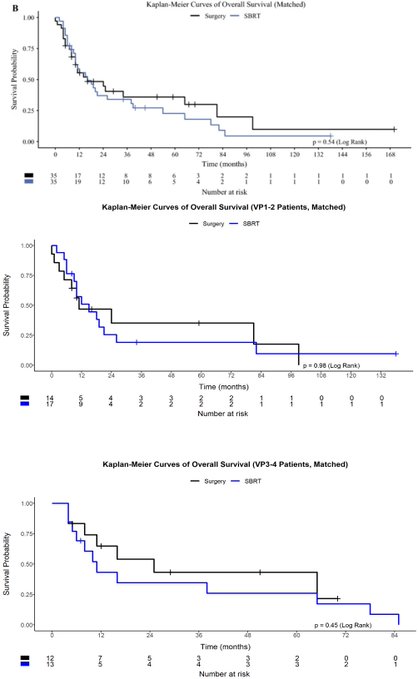 Jeffrey Ryckman: Surgery versus stereotactic body radiotherapy for treating hepatocellular carcinoma