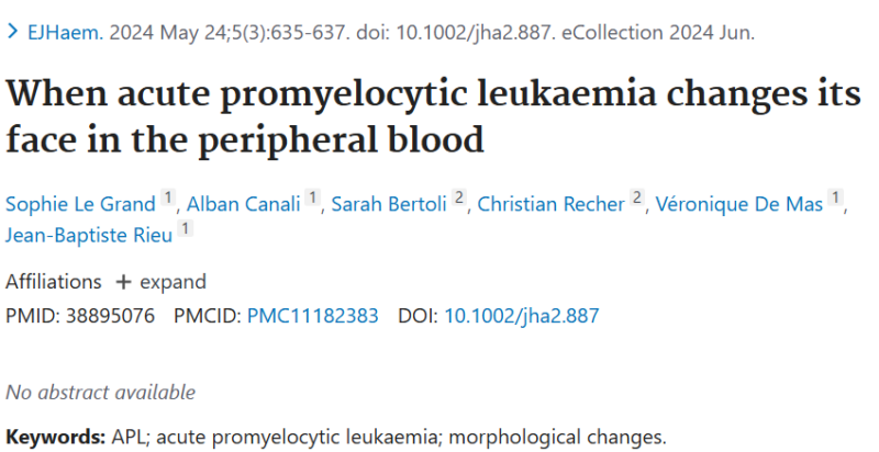 Siba El Hussein on rare presentations of Acute promyelocytic leukemia