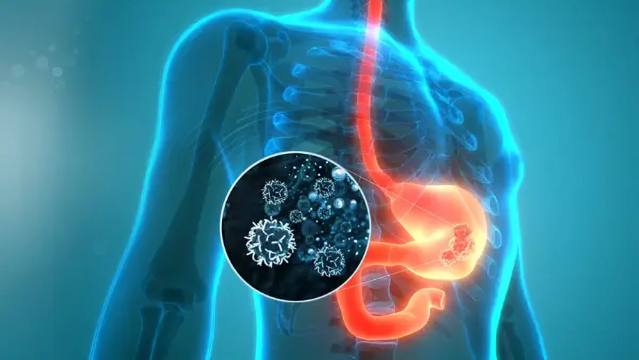 Neoadjuvant Chemotherapy plus Immune Checkpoint Inhibitors in Gastroesophageal Cancers