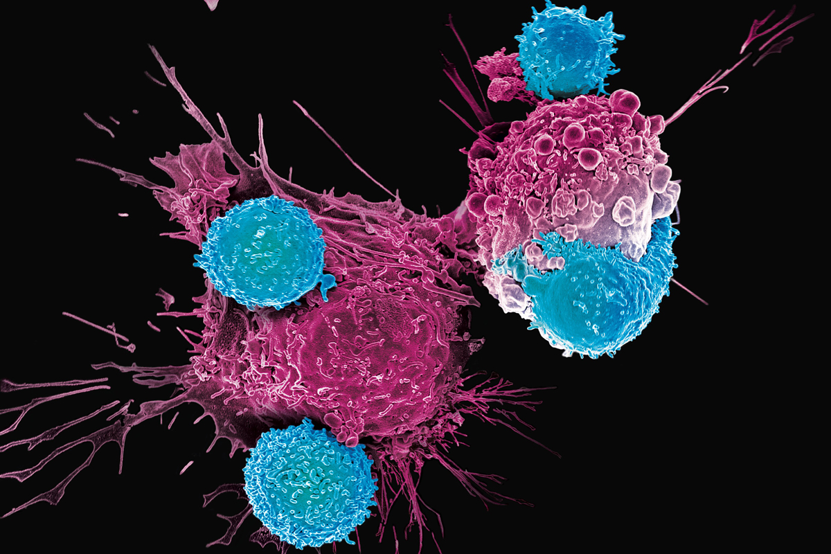 Rational CAR design for augmented T cell function – Journal for ImmunoTherapy of Cancer