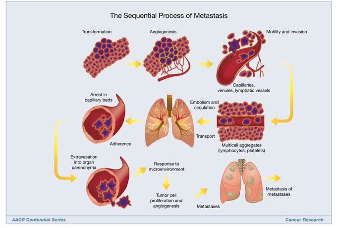 AACR Centennial Series: The Biology of Cancer Metastasis - Historical Perspective