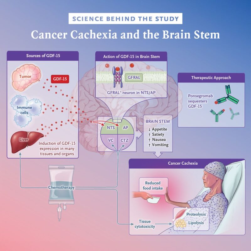 NEJM Group - The science behind a study of ponsegromab to treat cancer cachexia