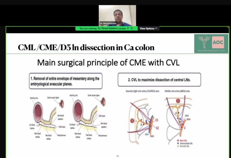 Highlights from Global Cancer Movement: Challenging the Status Quo in Colorectal Cancer - Day 3