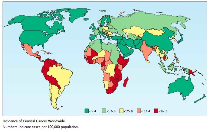 Elvina Almuradova: This is the Map Showing the Frequency of Cervical Cancer