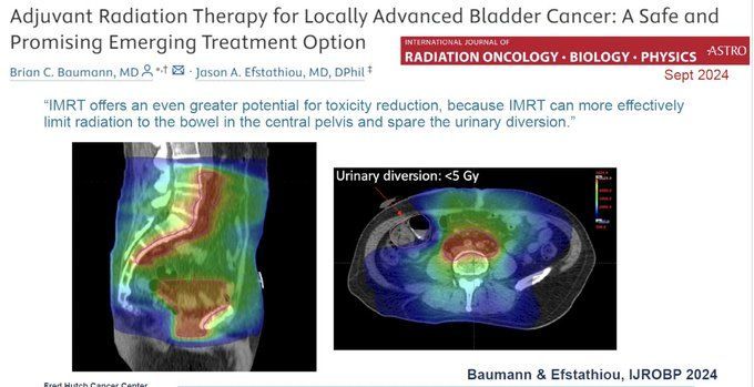 Enrique Grande: Adjuvant Radiation Following Cystectomy