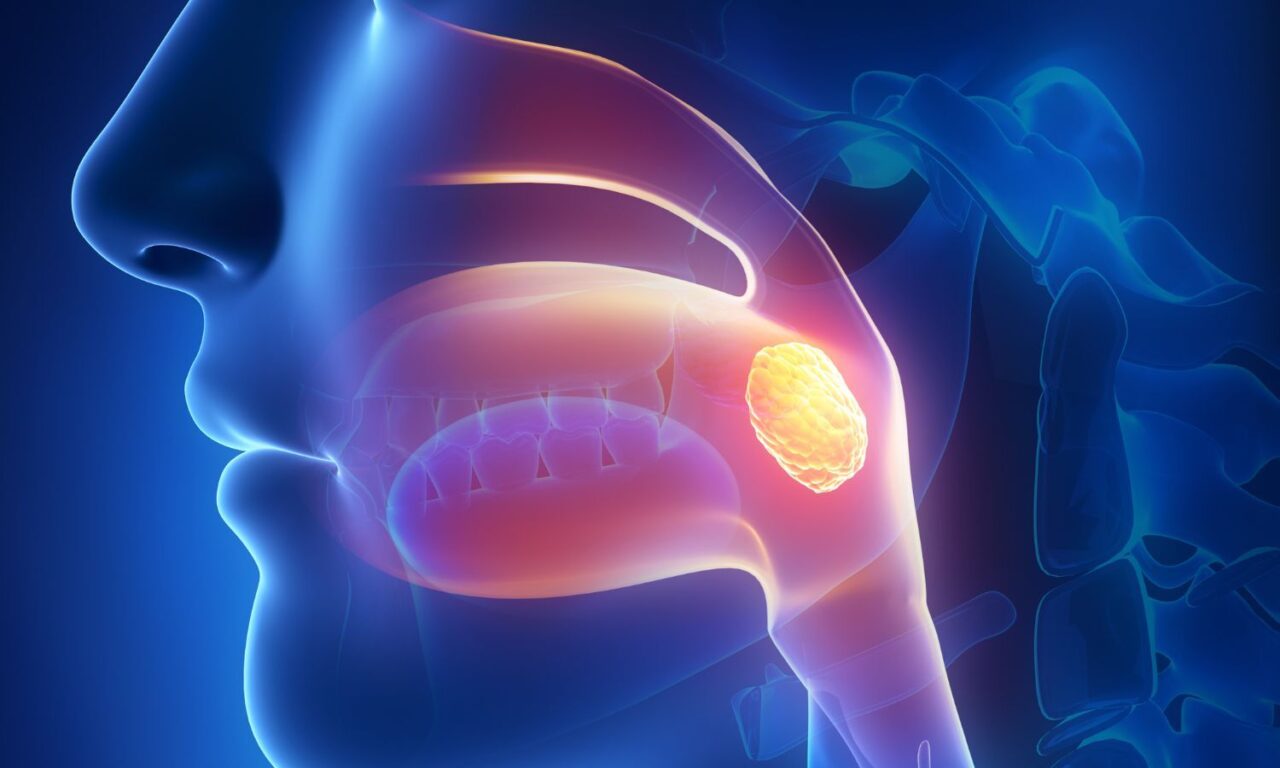 Optimizing Radiotherapy Timing for Nasopharyngeal Carcinoma