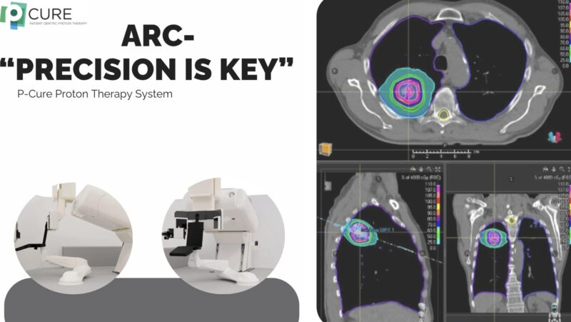 lung tumors