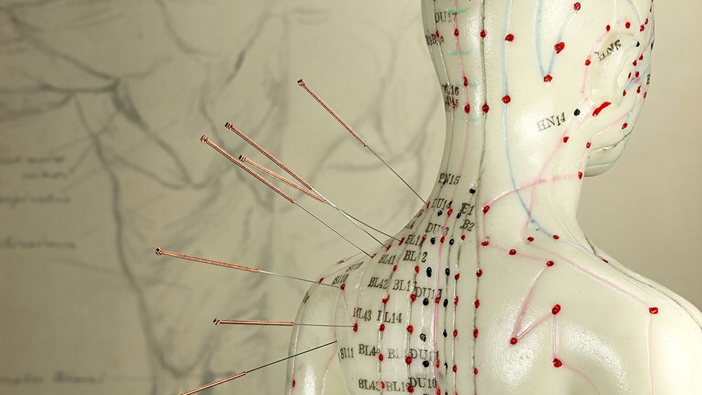 Control choice in acupuncture clinical trials involving patients with breast cancer by Barbara Bierer et al.